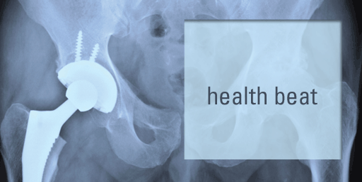 HEALTHBEAT